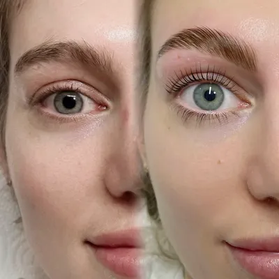 Lash lift treatment result