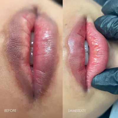 Lip blushing result